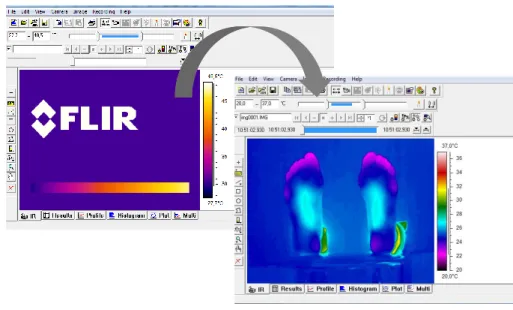 Figure 12- Illustration of ThermaCAM Researcher Pro software for an analysis of foot thermal image