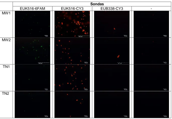 Tabela 7.Microfotografias de epifluorescência da bactéria E. coli, após a aplicação da técnica FISH  utilizando os diferentes protocolos de hibridação