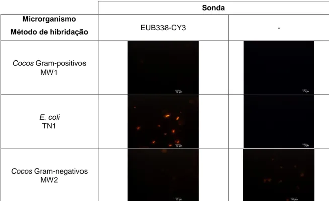 Tabela  11.Microfotografias  de  epifluorescência  das  estirpe  bacteriana  E.coli,  cocos  Gram- Gram-negativos e cocos Gram-positivos com o filtro TRITC (para o CY3), a aplicação da fixação com  microondas e do melhor método de hibridação