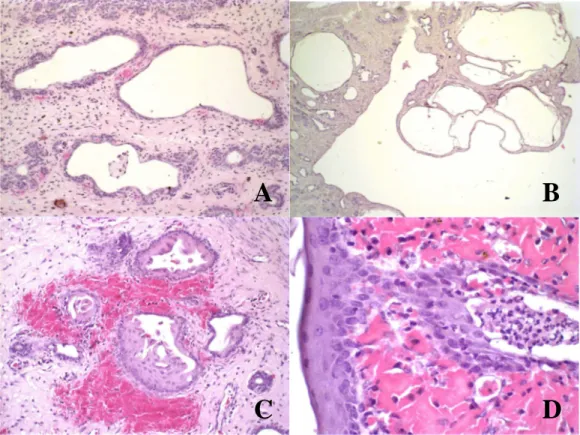 Figura  02  -  (A  e  B):  Animal  A2  (inteiro,  dose  0,5mg/Kg/dia).  (A)  Hiperplasia  endometrial  cística  tipo  I