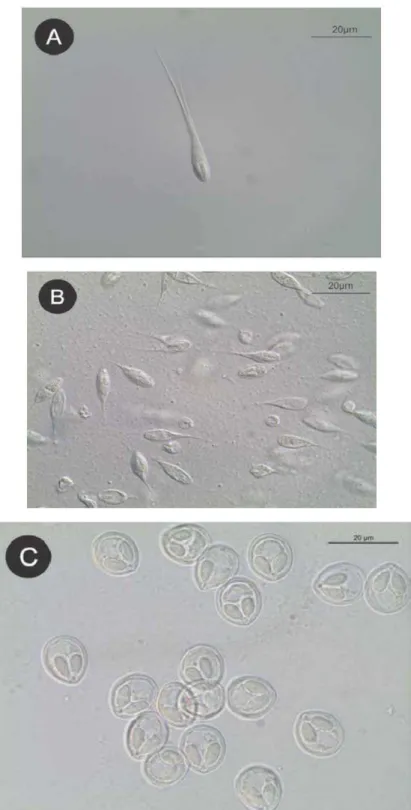 Figura 9. A. Esporos de Henneguya sp.1; B. Esporos de Henneguya sp.2; C. Esporos   de Myxobolus sp