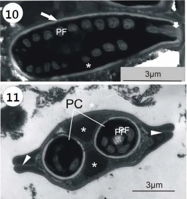 Figura 10-11. Microscopia Eletrônica de Transmissão do mixozoário Myxobolus sp. no peixe  Prochilodus lineatus