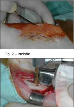 Fig. 1 – Anti-sepsia. Fig. 2 – Incisão.