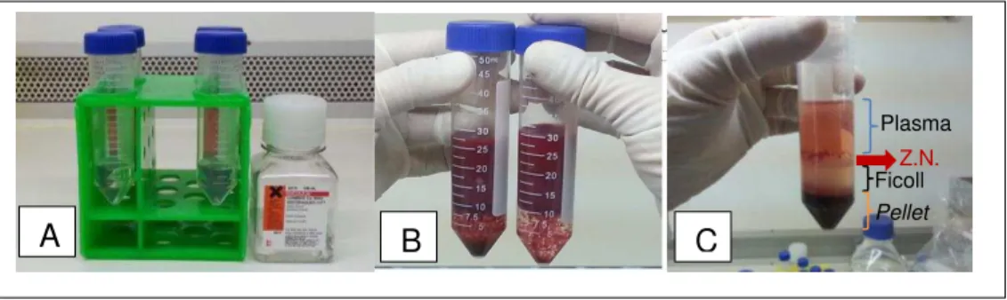 Figura  4  – Imagens  mostram  as  etapas  da  obtenção  do  concentrado  de  medula  óssea  através  do  método de gradiente de concentração com Ficoll  –  São Paulo - 2013-14 