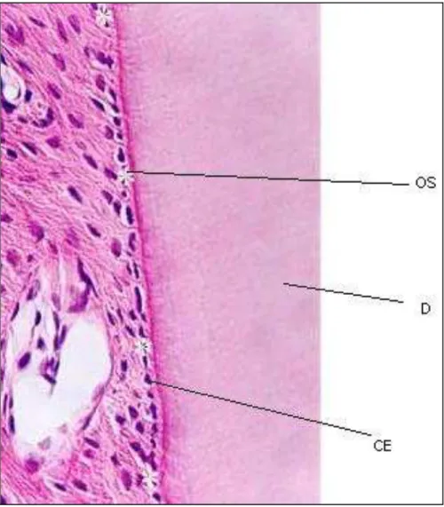 Figura  3  -  Corte  histológico  do  ligamento  periodontal.  Substituição  dos  cementoblastos  necrosados  por  osteoblastos