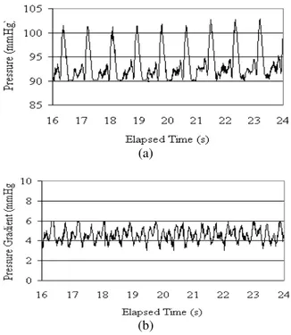 Fig.  8:  Resultant  pressure  wave  (a)  and  pressure  gradient  wave  (b)  for  experiments  with  viscosity  of  1  cP  and  wall  elasticity  of  0.56  MPa 