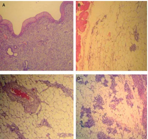 Fig 6: Cross-section from mammary gland. Note inactive mammary glands in control. A. And control-sham, B