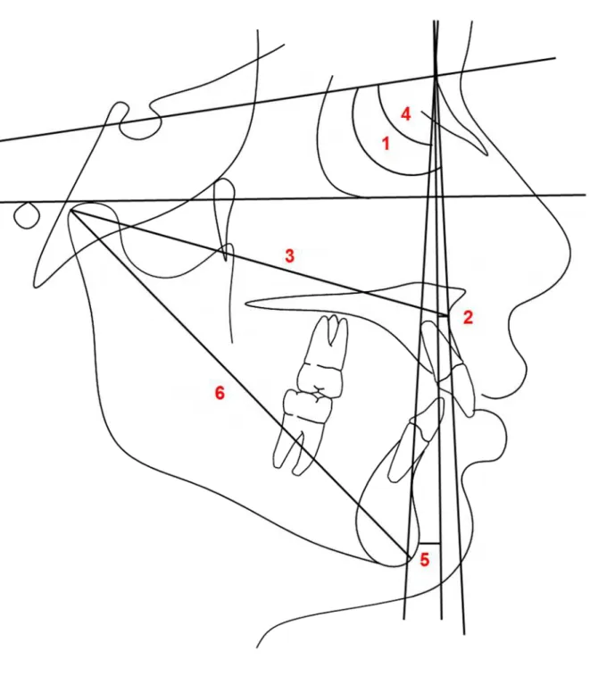 Figura 10 - Grandezas angulares e lineares esqueléticas do componente maxilar e mandibular 