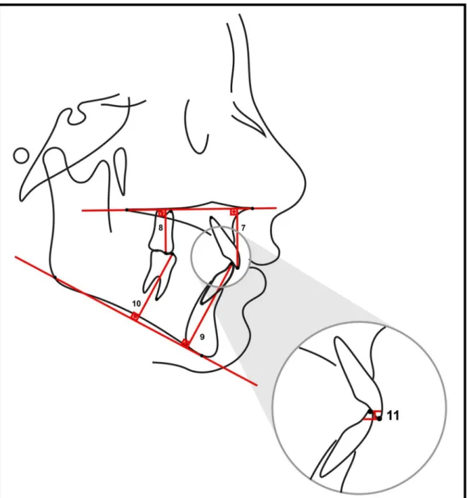 Figura 9 - Grandezas lineares dentárias verticais. 