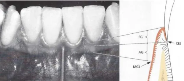 Figura  2  -  Constituintes  do  periodonto;  FG-gengiva  livre,  AG-gengiva  aderida,  CEJ-junção  amelocementária, MGJ-linha mucogengival (Adaptada de Lindhe, 2005).