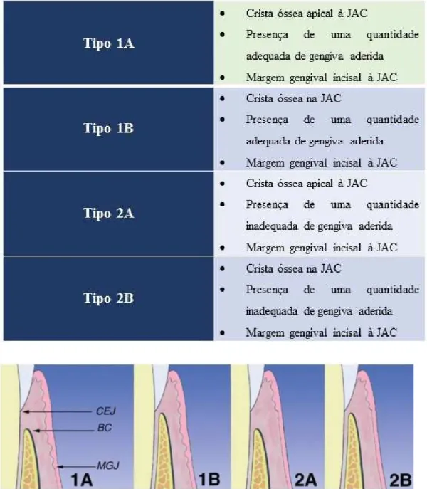 Tabela 1 - Classificação de Erupção Passiva Alterada (Adaptada de Chu et al., 2004). 