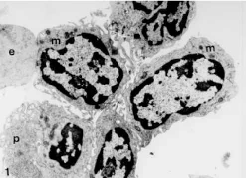 Fig. 1: general aspect of the mononuclear cells after collection from the Histopaque gradient