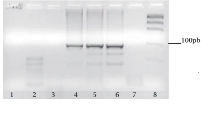 Figure  1:  Specific  repetitive  element  of  M.  leprae  (RLEP),  demonstrated  by  visualization  of  a  372bp  product