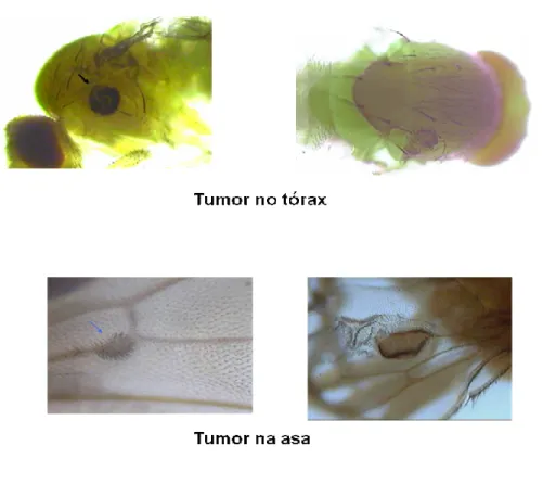 Figura 7 : Tumores epiteliais da linhagem wts no tórax e asa. 