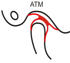 Figura 1 - Representação esquemática da ATM num corte sagital