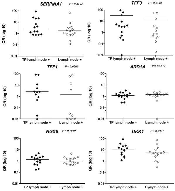 Figura 4. Comparação entre as médias dos níveis de expressão dos genes  SERPINA1, TFF3, TFF1, ARD1A, NGX6 e DKK1 das neoplasia malignas primárias 