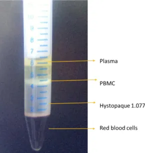 Figure 3.1. Isolation of blood peripheral mononuclear cells by density gradient. After centrifugation  on the hystopaque ® gradient the ring of  monocuclear cells, enriched in lymphocytes can be visualized