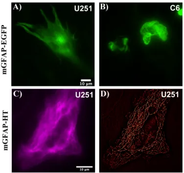 Figure 4.1: Halo mouse GFAP is successfully ex- ex-pressed  in  U251  human  glioblastoma  cells