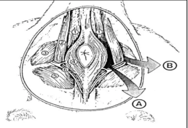 Figura 1. Relação anatômica de períneo normal (Lado direito)  a  de  uma  hérnia  perineal