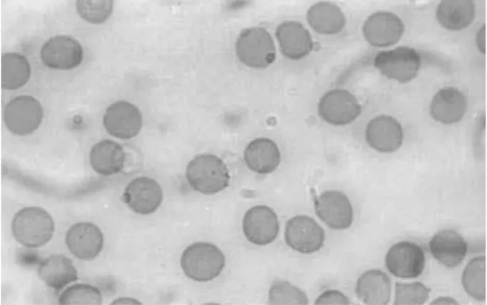 Figure 3. Photomicrography of blood smears prepared with  samples of whole blood used to label RBC with 99mTc  (control).