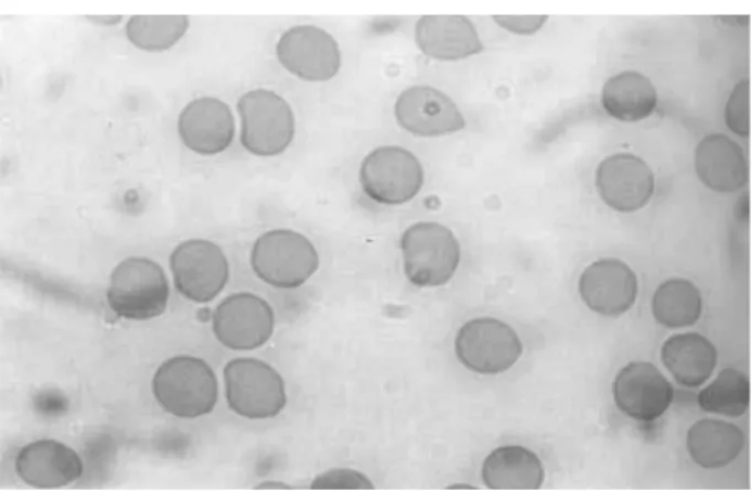 Figure 1 shows the distribution of the  radioactivity in plasma and red blood cells from blood  treated with different concentrations of Pfaffi a  sp