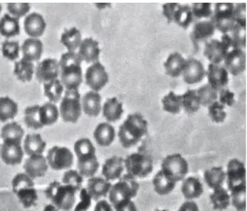 Figure  3.  Photomicrography  of  blood  smears  prepared  with  samples of whole blood used to label RBC with 99mTc (blood  samples  were  previously  treated  BM  extract  200  mg/mL)