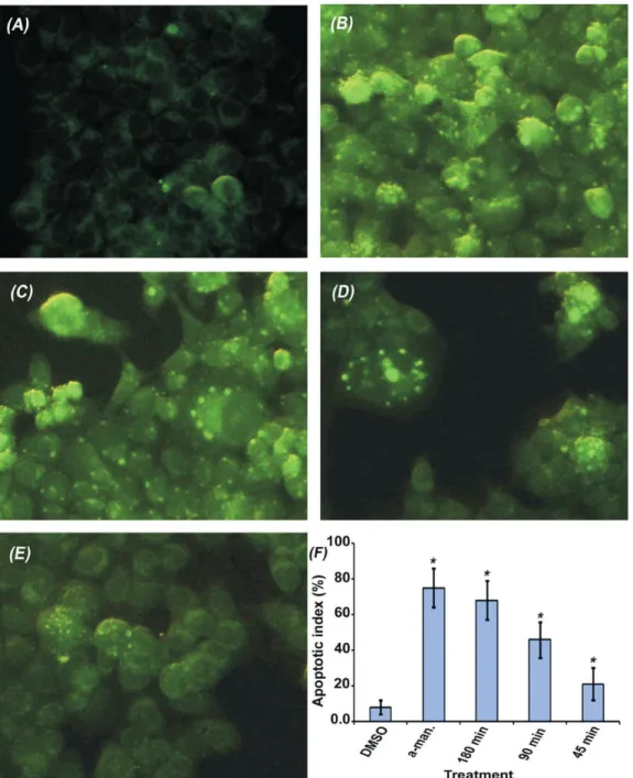 Figure 3.  Effect on mitochondrial membrane potential. Untreated cells (a), and the treated cells with; α-mangostin (b), the extract for  180 min (c), 90 min (d), 45 min (e) and a bar chart showing the apoptotic index of each treatment (f) (* indicates p v