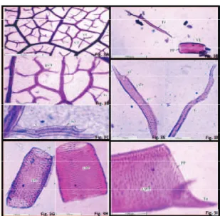 Figure 2. Microscopy of leafs and roots of of Cyclea peltata  Hook.  f.  &amp;  Thomson