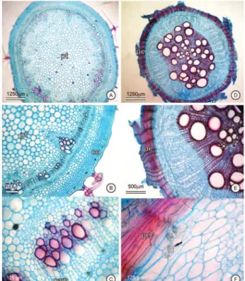 Figure 4. Solanum torvum Sw. (Agra &amp; Nurit 6758). A-C. Stem, in secondary growth, in cross section: A