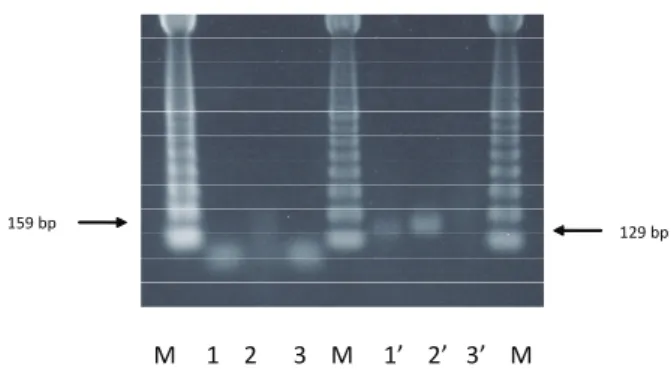Figure 1. RT-PCR and Nested-PCR for detection of HTLV-1  in  the  purified  virus  suspension