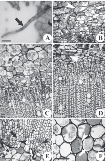 Figure  2.  Leaf  epidermal  peel  (A)  and  transverse  (B–F)  view  of  main  stem  of Solanum  pseudocapsicum L