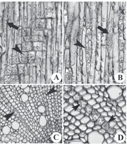 Figure 3. Radial (A), tangential (B) and transverse (C, D) view of xylem of Solanum pseudocapsicum L., Solanaceae