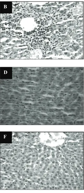 Figure 1. A. Liver sections of normal control rats. B. Liver sections of PCM treated rats