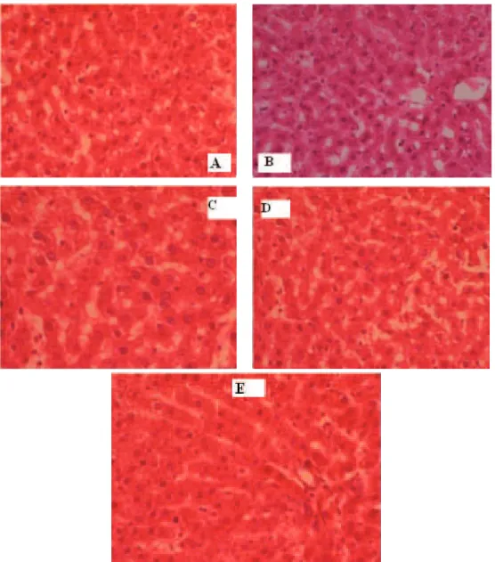 Figure 1. Typical photomicrograph of liver. A. Control group showing normal architecture of the hepatocyte; B