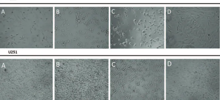 Figure 2.  Morphological analysis of U87-MG and U251 cell lines after 24 h treatment. Cells treated with A