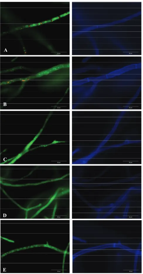 Figure 1. Images of epifluorescence microscope showing Aspergillus flavus after FUN-1 (left column) and CW (right column)  staining
