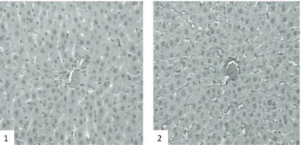 Figure 6. Photomicrography of liver (20x). 1. Experimental/Gb animals (G1); 2. Control animals (G2)