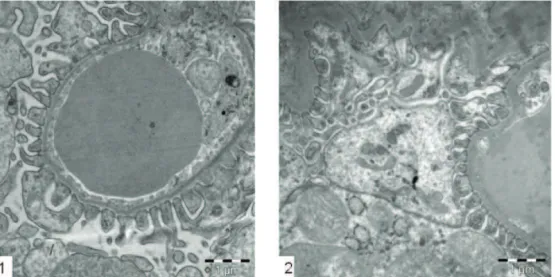 Figure 11. Group experimental/Gb (1) and Control (2) with 16700x showing healthy endothelium with pedicels and podocytes.