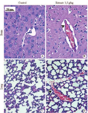 Figure  2.  Photomicrographs  of  brain  and  lungs  of  mice  subjected  to  toxicity  study  of  the  crude  ethanol  extract  of  Lychnophora  trichocarpha