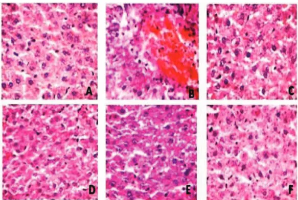 Figure 3. Histopathology report. A. Hepatocytes of the normal control group showed a normal lobular architecture of the liver; B