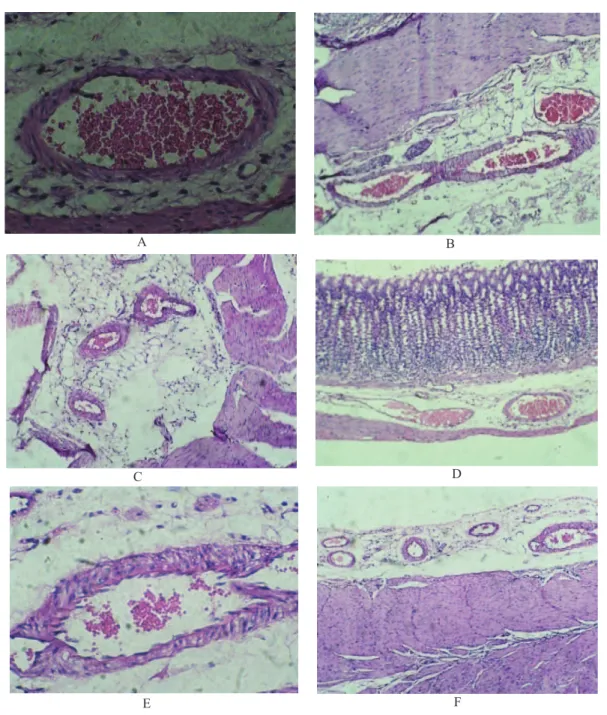Figure 1. Histological evaluation of gastric lesions of ulcerated rats stomach. A. Control (distilled water), (H&amp;E stain, 10×); B
