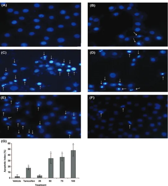 Figure  5.  Apoptosis  studies  on  MCF-7  cells  by  nuclear  staining  with  Hoechst  33258