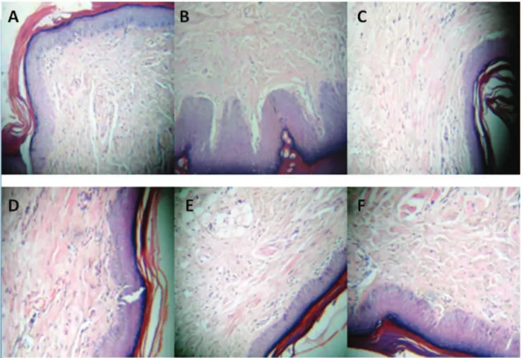 Figure 2. Histological analyses (HEX200) of paws from different groups belonging to the histamine-induced paw edema model