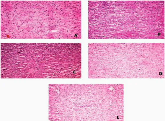 Figure 1. Histopathology of liver. A. The liver of the rats treated with saline; B. The liver of the rats treated with dexamethasone; C