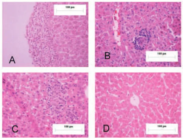 Figure  1.  A.  Example  of  a  mixed  granuloma  (M);  B.  Example  of  an  organized  granuloma  (O);  C
