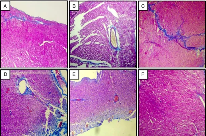 Fig. 4. Effect of administration of FLC and captopril on heart histology in 2K1C hypertensive Wistar rats