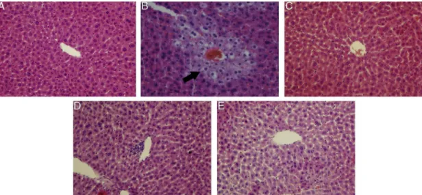 Fig. 2. Effects of AEO on the histological changes of the liver after CCl 4 treatment in mice (original magnification 400×): (A) control group; (B) CCl 4 -intoxicated group (model group); (C) bifendatatum (10 mg/kg) + CCl 4 ; (D) AEO (100 mg/kg) + CCl 4 ; 