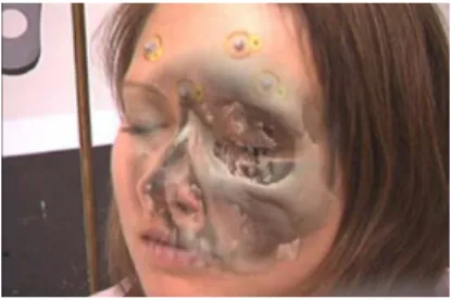 Figure  4  –  System  that  allows  viewing  through  the  skin  (source: 