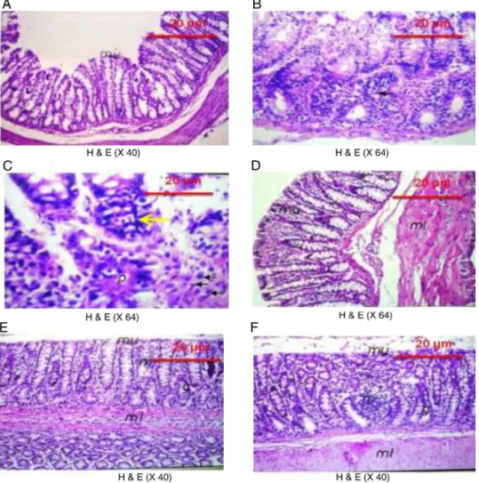 Fig. 5. Representative photomicrographs of colon tissue with or without N-MNU-induced CRC
