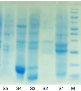 Fig. 7. SDS protein gel comparing different types of Erythrina. M, Marker; S1, Eryth- Eryth-rina × neilli; S2, E